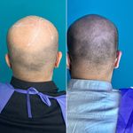 اولین مرکز میکرواسکالپ مشهد تاپ اسکالپ