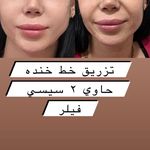 کلینیک پوست و مو و لیزر نیلوفر آبی
