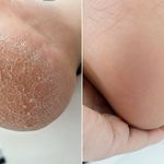 خدمات ناخن،کفسابی پدیکور،موخوره‌گیری