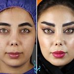 کلینیک زیبایی برنا