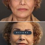 کلینیک پوست و مو موتاکس ملکی