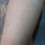 خدمات اپیلاسیون نورانی