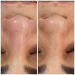 مرکز تخصصی فیشال و پاکسازی پوست تینا