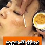 کرم ضدلک وسفیدکننده vip