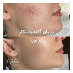 کلینیک زیبایی و لیزر مو زائد نوبا