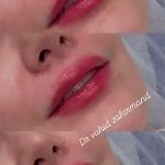 کلینیک زیبایی آرت اسکین