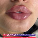 کلینیک زیبایی شایلی