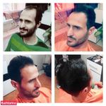 پیرایش کارینو