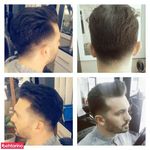 پیرایش کارینو