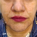 كلينيك زيبایی و ليزر دكتر اميررضا طاهری