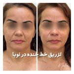 کلینیک زیبایی و لیزر مو زائد نوبا