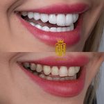 دندانپزشکی دکتر قاسم نژاد *بیمه نداریم*