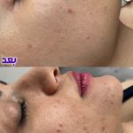 مرکز تخصصی پوست تحت نظر پزشک (رضایی)