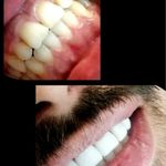 دندانپزشکی اقساطی بدون سود شهرری