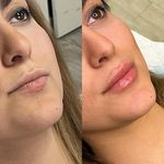 دکتر زینب قیاسوند پزشک زیبایی