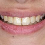 فتوگرافی پزشکی تکرنگ طب
