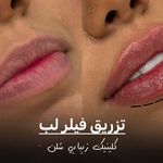 کلینیک زیبایی سُلِن