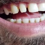 کلینیک دندان پزشکی و ایمپلنت الیسو