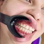 کلینیک دندان پزشکی و ایمپلنت الیسو