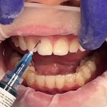 کلینیک دندان پزشکی و ایمپلنت الیسو
