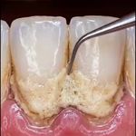 کلینیک دندان پزشکی و ایمپلنت الیسو