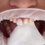 کلینیک دندان پزشکی و ایمپلنت الیسو
