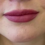 کلینیک دندان پزشکی و ایمپلنت الیسو