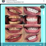 دندانپزشکی دکتر سینا عطاپور