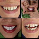 دکتر دندانپزشک ندا حیدری (متخصص لمینیت)