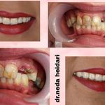 دکتر دندانپزشک ندا حیدری (متخصص لمینیت)