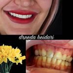 دکتر دندانپزشک ندا حیدری (متخصص لمینیت)