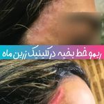 کلینیک زیبایی مرکز لیزر و لاغری زرین ماه