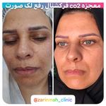 کلینیک زیبایی مرکز لیزر و لاغری زرین ماه