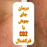 کلینیک زیبایی مرکز لیزر و لاغری زرین ماه
