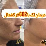 کلینیک زیبایی مرکز لیزر و لاغری زرین ماه