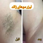 کلینیک زیبایی مرکز لیزر و لاغری زرین ماه