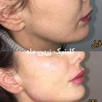 کلینیک زیبایی مرکز لیزر و لاغری زرین ماه