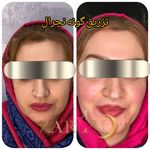 کلینیک زیبایی مرکز لیزر و لاغری زرین ماه