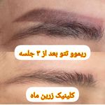 کلینیک زیبایی مرکز لیزر و لاغری زرین ماه