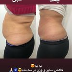 کلینیک زیبایی مرکز لیزر و لاغری زرین ماه