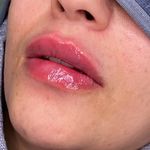 کلینیک زیبایی مرکز لیزر و لاغری زرین ماه