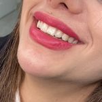 کلینیک زیبایی مرکز لیزر و لاغری زرین ماه