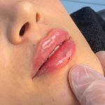 کلینیک زیبایی مرکز لیزر و لاغری زرین ماه