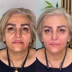 کلینیک زیبایی مرکز لیزر و لاغری زرین ماه