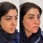 کلینیک زیبایی مرکز لیزر و لاغری زرین ماه