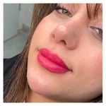 کلینیک زیبایی مرکز لیزر و لاغری زرین ماه