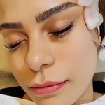 مرکز مراقبت از پوست ماه رخ خوارزمی