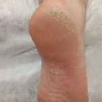 کفسابی و پدولوژی ناخن خانمها و آقایان