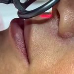 کلینیک زیبایی مرکز لیزر و لاغری زرین ماه