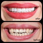 دکتر دندانپزشک ندا حیدری (متخصص لمینت)